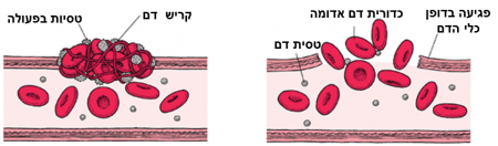 איך מבצעים עצירת דימומים?