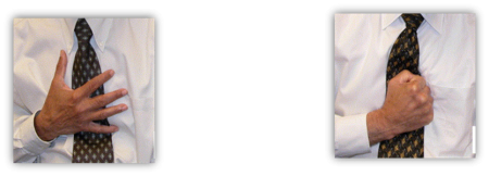 ‫חשד לאירוע קורונרי חריף‬ - ACS